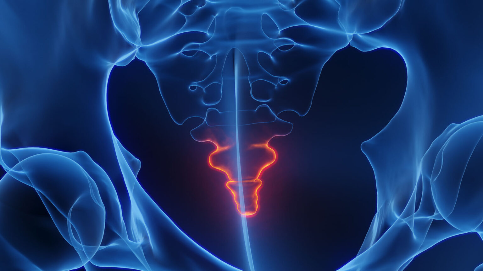 Pars Block Injection Ganglion of Impar Block Injections Melbourne